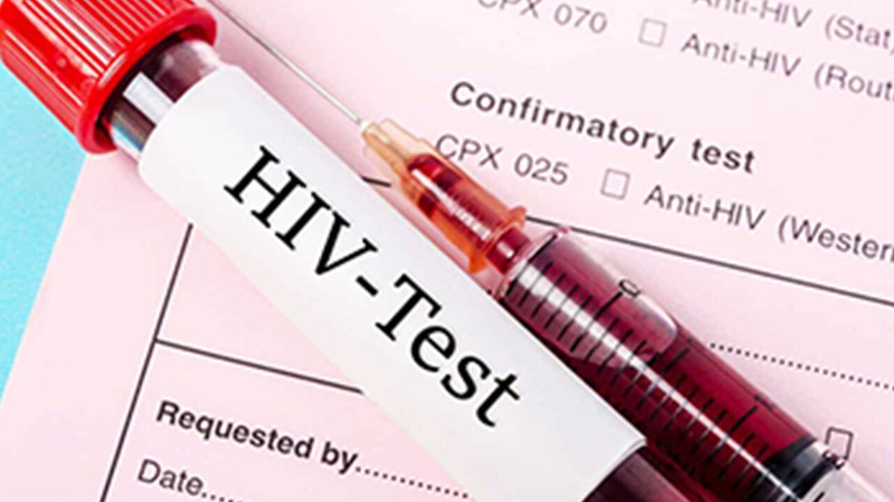 Botswana officially joins Top 20 HIV worst hit countries