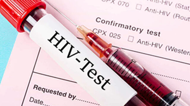 Botswana officially joins Top 20 HIV worst hit countries
